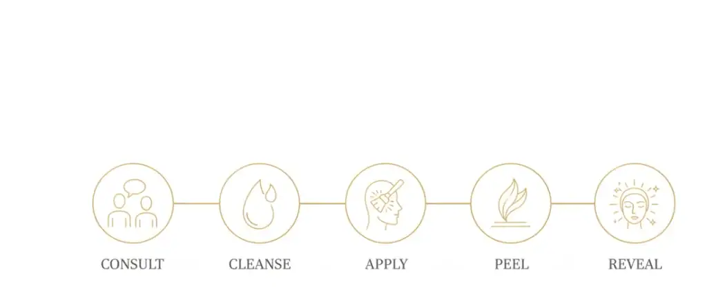 Chemical peel process at Derma Secret Mississauga: consult, cleanse, apply, peel, reveal